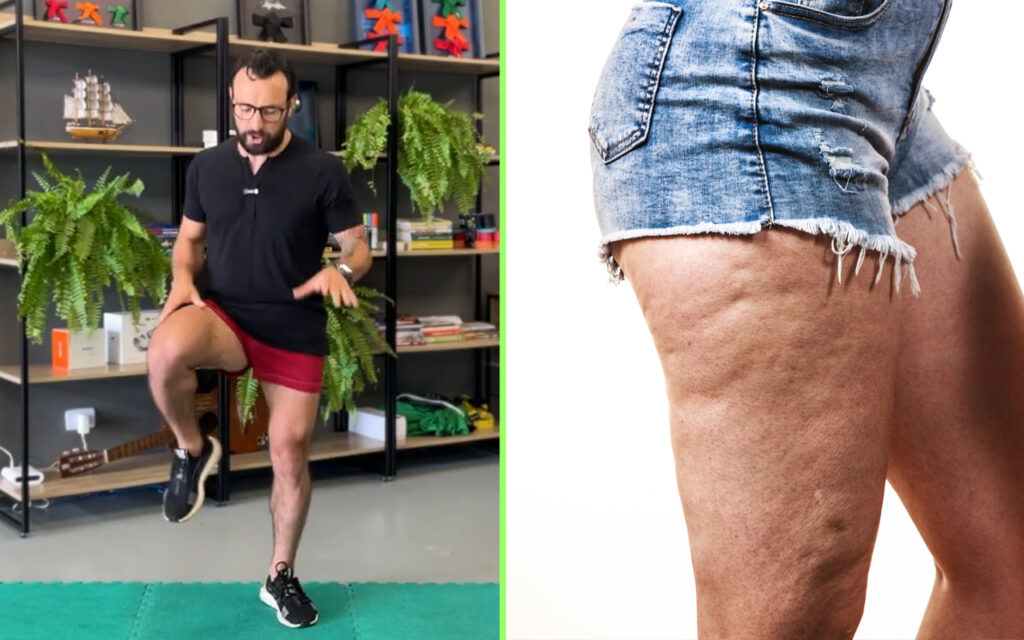 3 exercicios para eliminar celulite das pernas